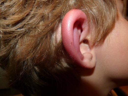 귀를 부수는 방법?
